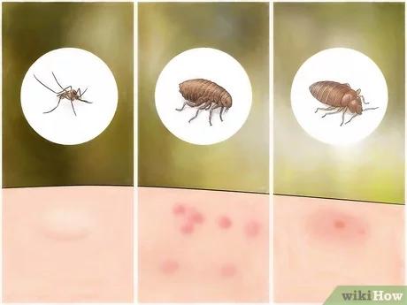 صورة عنوانها Identify Insect Bites Step 2