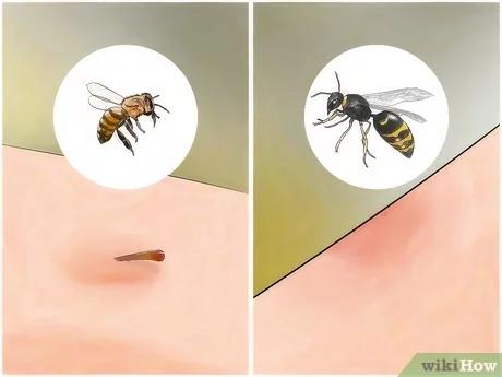 صورة عنوانها Identify Insect Bites Step 4