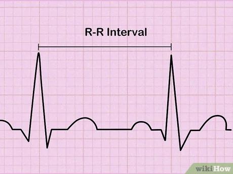 صورة عنوانها Read an EKG Step 5